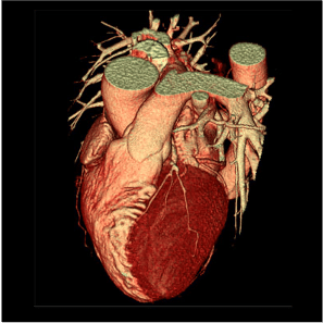 2 Cardiovasculaire 2 Imagerie Cardio-Vasculaire