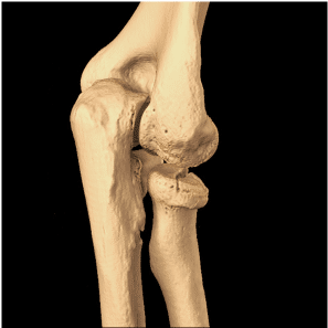 5 Osteo articulaire 2 Imagerie Ostéo-Articulaire