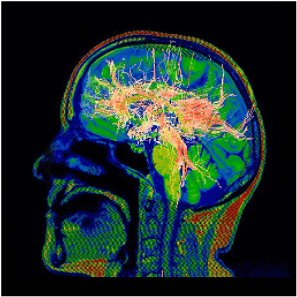 6 neuroradiologie 2 Neuroradiologie