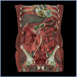 1-abdominale imagerie abdominale Paris