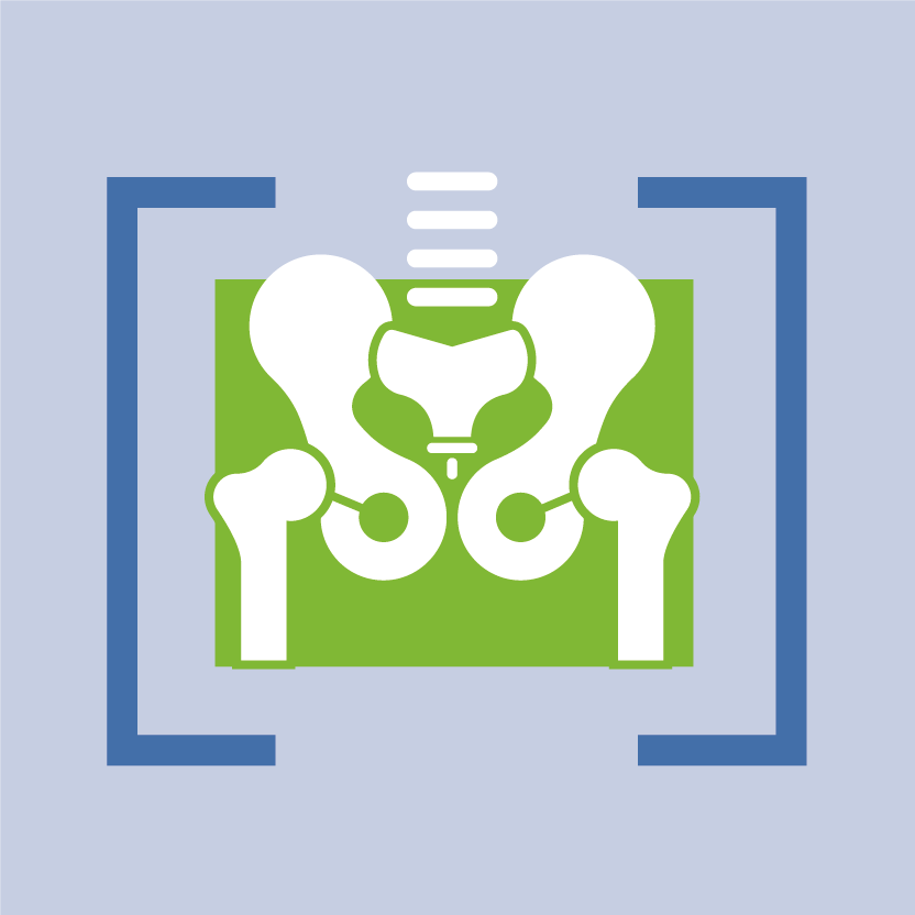 CSE-Ostheodensitrometrie Radiologie - Imagerie médicale Faidherbe Mont-Louis